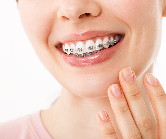 Smile with Braces Orthodontic Treatment.