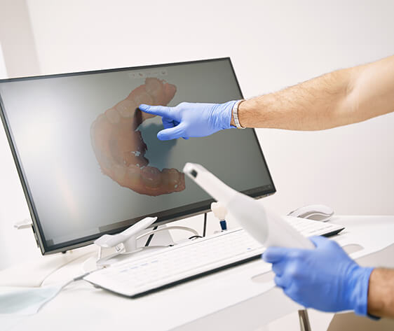 Male dentist hand pointing at computer display with dental 3D scan